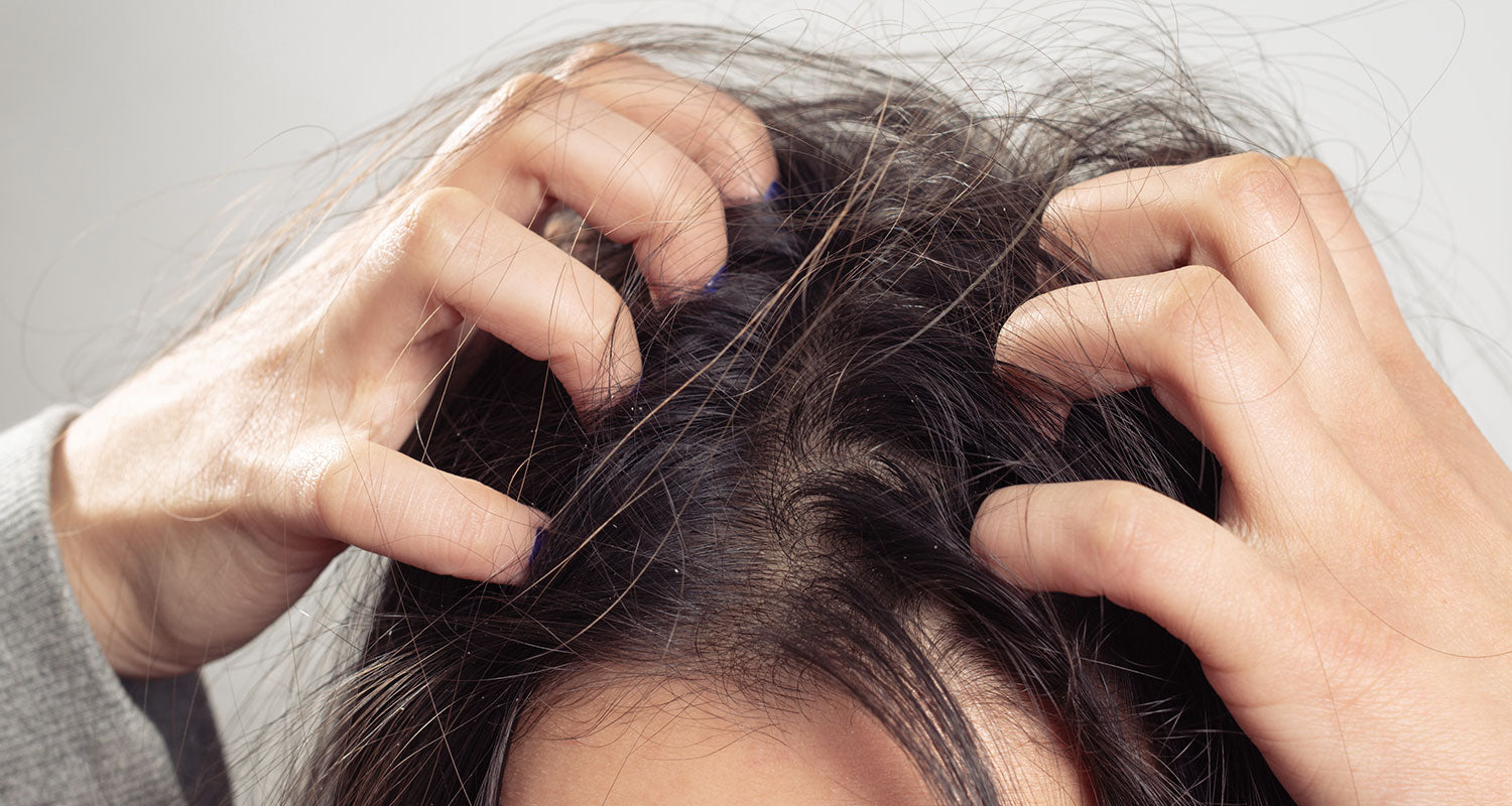 Does scalp psoriasis ever go away? (...and other common questions)